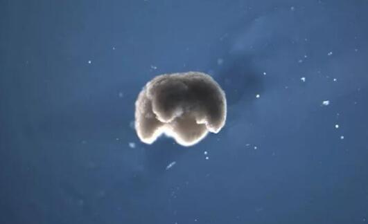 專家稱新冠病毒傳播方式邪惡