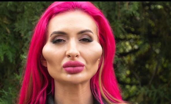 網(wǎng)紅模特自稱擁有世界最大臉頰