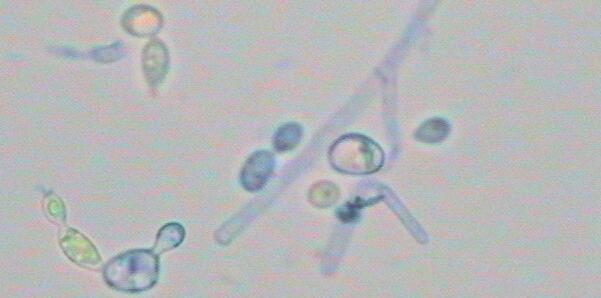 致命真菌在美國(guó)蔓延