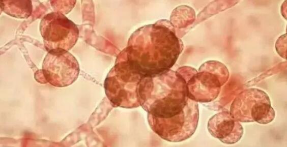 致命真菌在美國(guó)蔓延