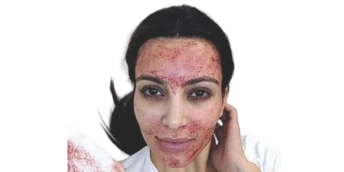 美國(guó)多人使用吸血鬼面膜感染